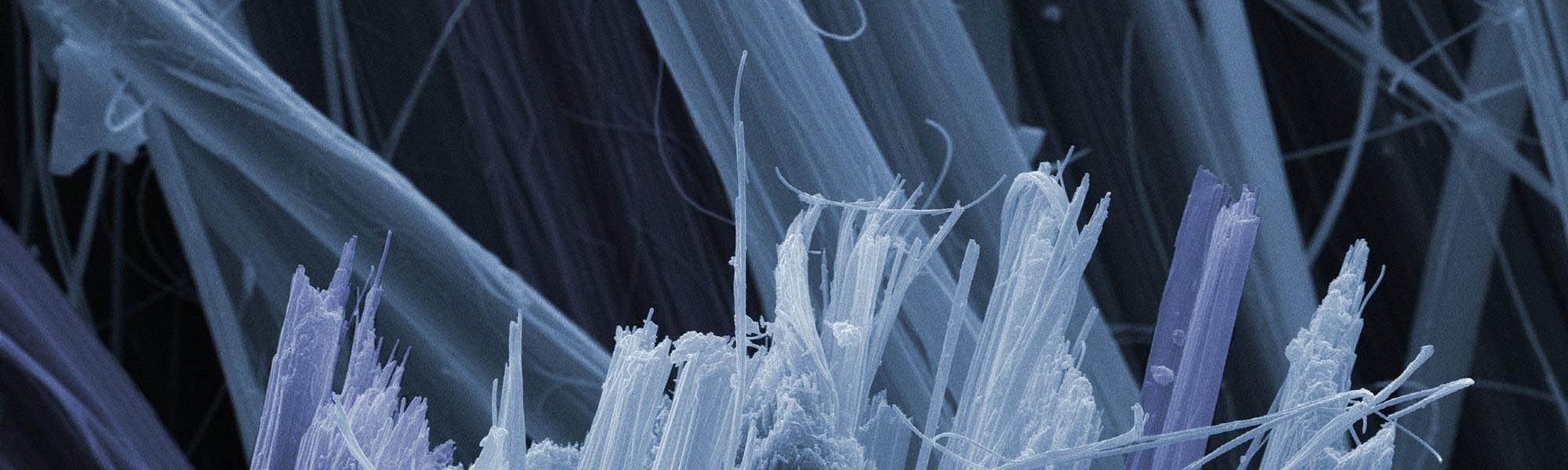 Asbestos in the Home